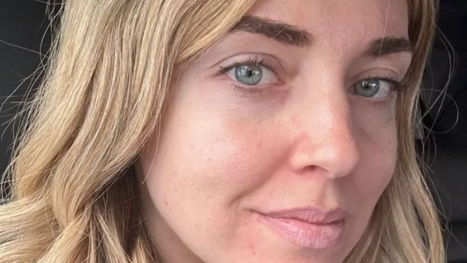 Il trucco di Chiara Ferragni? Nessuno!